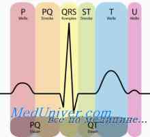 Tri standardne EKG elektrode. Prsa kanalni elektrokardiogram