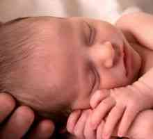 Emfizem u novorođenčadi