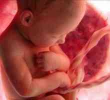 Erythroblastosis fetusa: uzroci, liječenje, simptoma