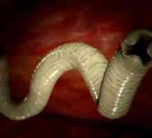 Koje su dimenzije crva (helminta) u ljudi?