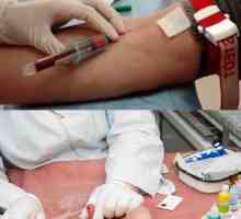 Što je krvni test određuje crva u dijete i odrasla osoba, opći, IFA iz vene?