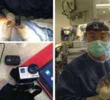 GoPro kameru trenirati kirurga