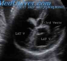 Klasifikacije fetalnih anomalija. Uzi biljezi razvojnih abnormalnosti