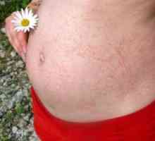Osip na koži u trudnoći