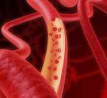 Krvarenje uzrokovano oštećenje krvnih žila