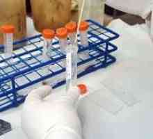 Laboratorijska dijagnostika teniasis (svinjetina trakavice)