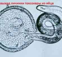 Ličinke i jaja Toxocara visceralni toxocariasis