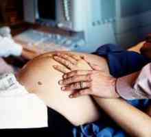 Listerioze u trudnoći, simptomi, liječenje