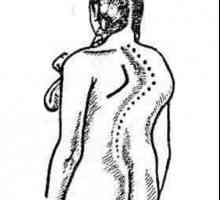 Tehnika masaže sa skoliozom