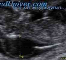 Metode za procjenu ultrazvuk nuhalni nabor. Ponovljivost mjerenja potiljačni