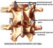 Intervertebralnog (dugootroschatye) zglobova
