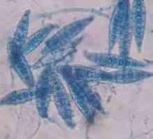 Microsporidiosis kod ljudi: simptoma, liječenje