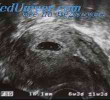 Je li potrebno provesti ultrazvuk svaki trudna. Što se tiče potrebno je ultrazvučni probir trudnica?