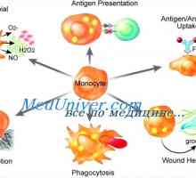 Disfunkcija monocita i makrofaga imunitet