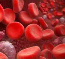 Poremećaji krvarenja: opće odredbe, simptomi, uzroci