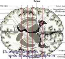 Neurotransmiteri su bazalni gangliji. Parkinsonova bolest