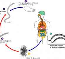 Nematoda kod ljudi, vrsti glistama (crvi, paraziti, helminti)