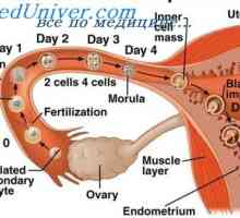 Nenormalan mjesto implantacija embrija. Jajnika i trbuhu trudnoća