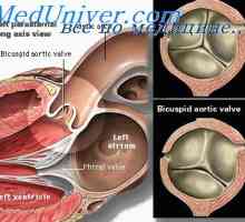 Obrazovanje aorte ventila. Odvajanje fetusa arterijske prtljažniku