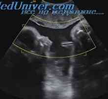 Razgovarajte o sigurnosti ultrazvuka korištenja. Utjecaj ultrazvuka na tkiva