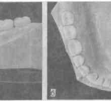 Procjena stanja zubi