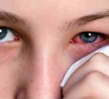 Ophthalmoherpes: liječenja, simptomi