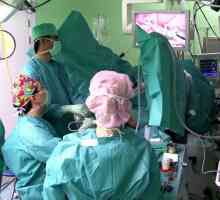 Operacija za uklanjanje crijeva diverticula