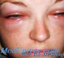 Inspekcija (fizikalni pregled) djeteta s alergijama