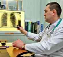 Akutna upala pluća, liječenje