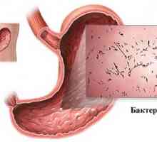 Akutni zarazni gastroenteritis