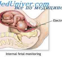 Odreda i porod posteljice. Bol tijekom poroda
