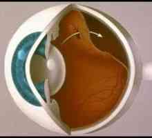 Odvajanje mrežnice očiju: uzroci, simptomi, liječenje, simptomi