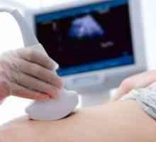 Patologija fetalnog razdoblja razvoja