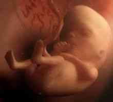 Perednegolovnoe fetusa prezentacija