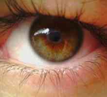 Pigmentni degeneracija mrežnice tretmana oka