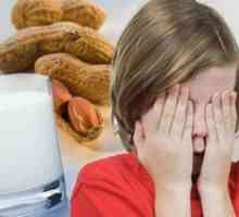 Alergije na hranu kod djece starije od 7 godina