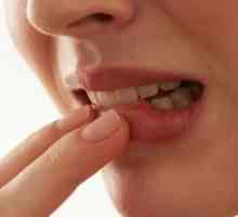 Karcinom skvamoznih stanica usne šupljine: liječenje, simptoma, prognoza