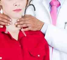 Subakutni tiroiditis štitnjače: liječenje, simptoma, učinaka, dijagnoze