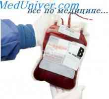 Indikacije i kontraindikacije za transfuziju crvenih krvnih stanica u novorođenčadi