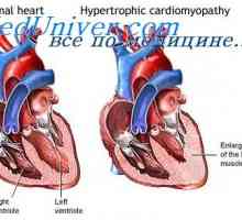 Mišića protok krvi. Hipertrofija srca za vrijeme treninga