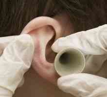 Poraz uho: kada se uzimaju lijekove s herpes zoster
