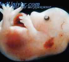 Sekvenca mijelinacije. glava fetusa diferencijaciju mozga