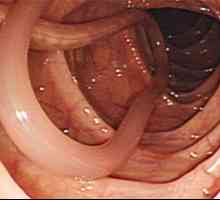 Posljedice i komplikacije crijevnih crva u ljudi