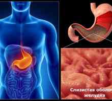Uzroci kroničnog gastritisa