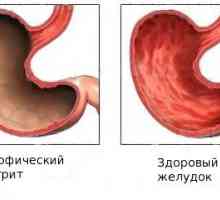 Primjena Maalox gastritis
