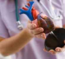 Znakovi i simptomi srčanih bolesti u žena