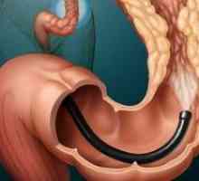 Ljudski debelog crijeva