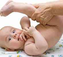 Ostalo patologija u novorođenčadi