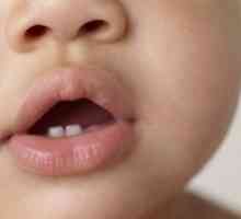 Dobivanje zuba u djece (djeca, djeca): simptomi, znakovi