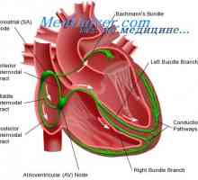 Srčanu provodljivost sustav. sinusnog čvora